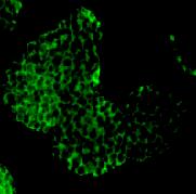 Amyloid Beta A4 Precursor (APP)